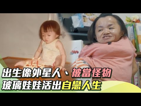 愛不脆弱/出生像外星人、被當怪物 玻璃娃娃活出自戀人生|人生驚嘆號|祝你健康