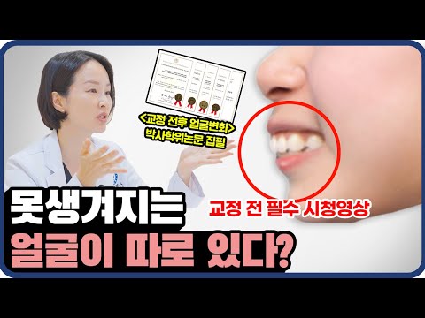 ()교정했는데 못생겨지는 얼굴이 따로 있다? I 교정하고 얼굴 변한 것 같은 사람 필수 시청!