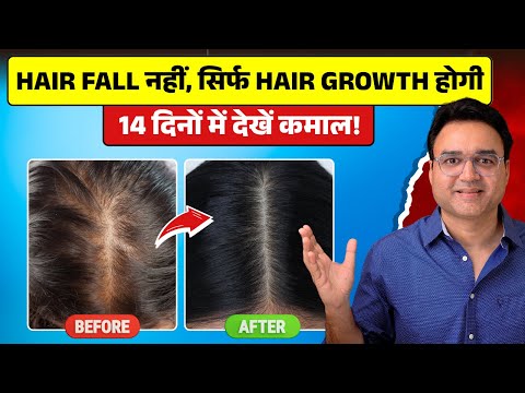 कितने भी पतले कमज़ोर झड़ते बाल हों, दोगुनी तेज़ी से उगेंगे | 4 Best Remedies For Hair Fall