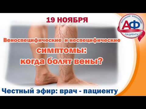 Veno-specific and non-specific symptoms: when do veins hurt?