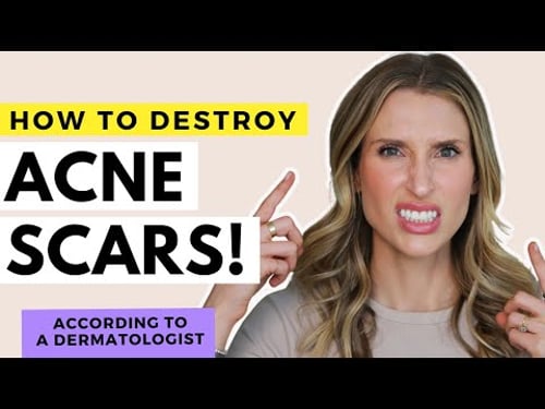 Acne Scar Treatments That Work! | Dr. Sam Ellis