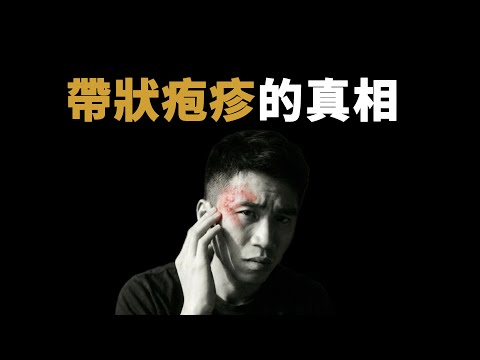 藏在90%的人體內的病毒,為什麼它沒有像天花一樣滅絕,為什麼會讓人這麼疼|鹿哥Gustav