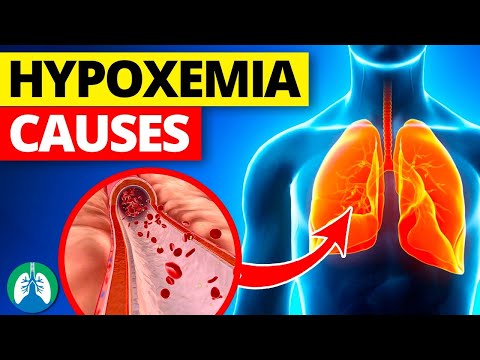 THIS is Causing Your Low Oxygen Levels | Hypoxemia Causes