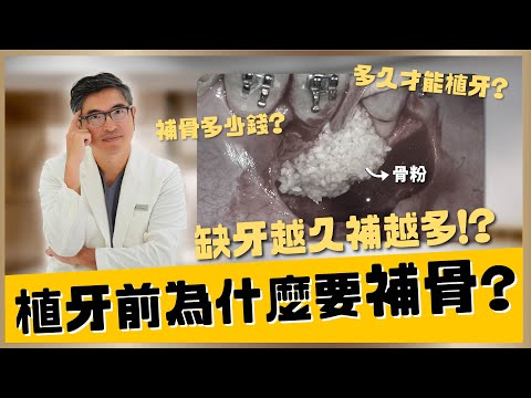 【植牙 #7】植牙前為什麼要補骨?補骨是什麼?補骨的方法、原理、價格、種類和適用情況一次告訴你!植牙補骨超詳細解析✨|【祐民牙醫-隱適美旗艦店】鑽石級楊大為醫師 #植牙 #補骨 #拔牙 #缺牙