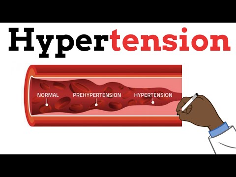 Hypertension - Best for beginners (Risk factors, Pathophysiology, Causes, Diagnosis, Medications)