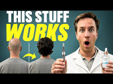 4x Minoxidil results with Microneedling (Use Them Now)