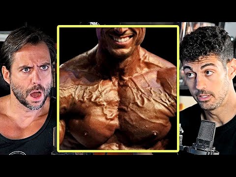 Cardiologist has taken bodybuilders and tells of the atrocities he has seen them do