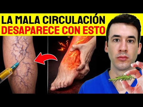 ¡Cura las várices en las piernas con este secreto! - Mejora la circulación