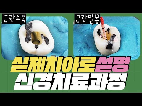 ์น์์ ๊ฒฝ์น๋ฃ ๊ทผ๊ด์น๋ฃ ๊ณผ์ /๊ธฐ๊ฐ/ํต์ฆ