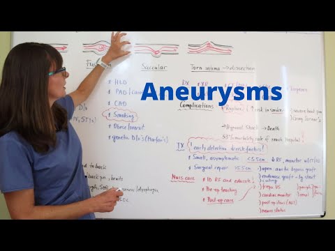 Aneurysms