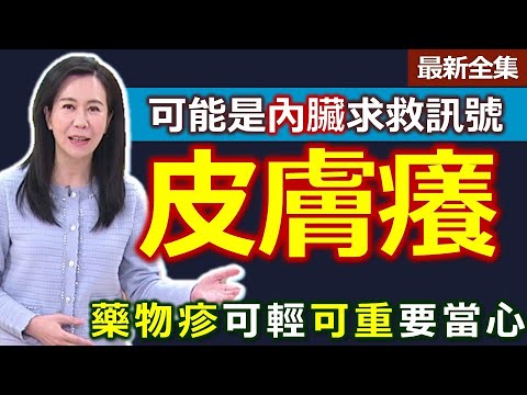 健康好生活 202300503 莫名「發癢」是徵兆? 警覺分辨就醫救命!