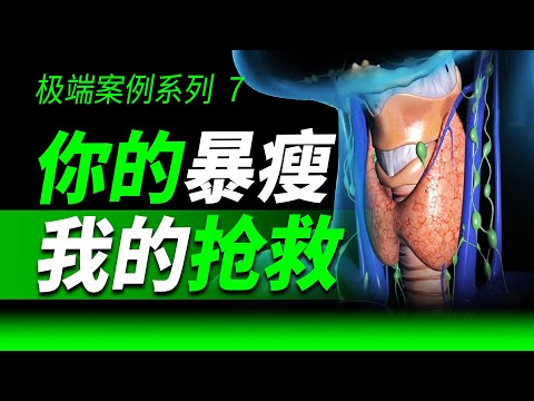 两个28岁女生打赌减肥三个月却偷吃减肥药,她们身体发生了什么变化?【减肥药系列 1】