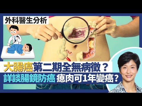 預防大腸癌及腸鏡檢查|大腸癌直至第二期頭半都無病徵 不適求醫9成已癌症第三期?照大腸鏡5年1次未必夠 部分瘜肉1年已變癌症?詳談腸鏡風險 幾類人要醫院照|王建芳醫生 外科醫生楊丕祥醫生|人類健康研究所