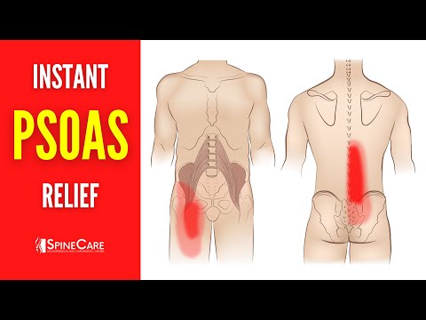 How to INSTANTLY Relieve Psoas Muscle Pain