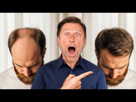 How to Reverse Hair Loss