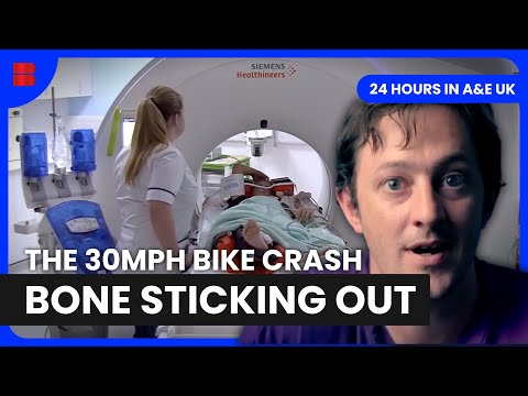 8 Year Old Hit By Car Open Fracture Emergency | 24 Hours In A&E UK