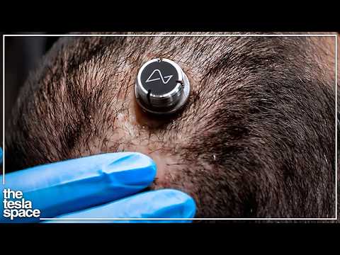 Neuralink Reveals Another New Human Patient!