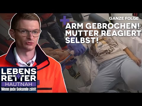 Mutter richtet Knochen selbst – Kind mit Armbruch nach Sturz | Lebensretter hautnah | SAT.1