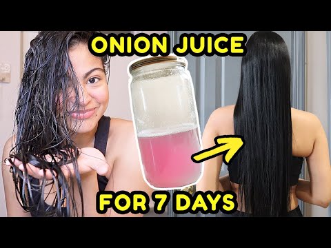 I tried ONION JUICE on my hair FOR 7 DAYS & THIS HAPPENED! *before & after results*