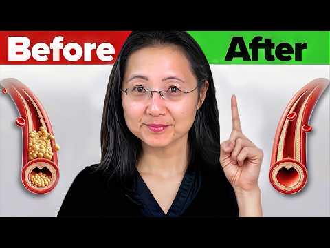 The #1 Best Natural Foods to Clean Out Arteries