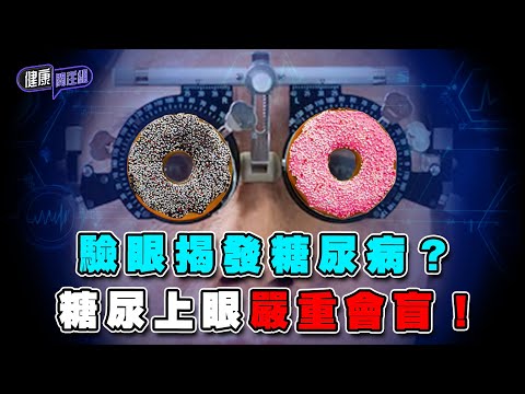 驗眼揭發糖尿病? 糖尿上眼嚴重會盲!| 健康關注組 | EP322 | 糖尿上眼 | 糖尿病 | 吳雲甫 | 朱智賢 | HOY TV 77台