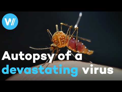 Zika: the race against time to contain the virus that shrinks babies' brains