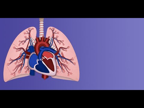 Persistent Pulmonary Hypertension of the Newborn: Pathophysiology by A. Moscatelli | OPENPediatrics