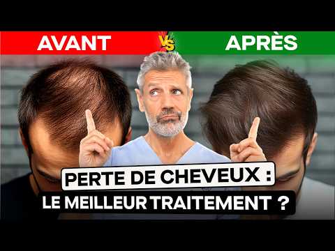 Are you losing your hair? Here's what REALLY works.