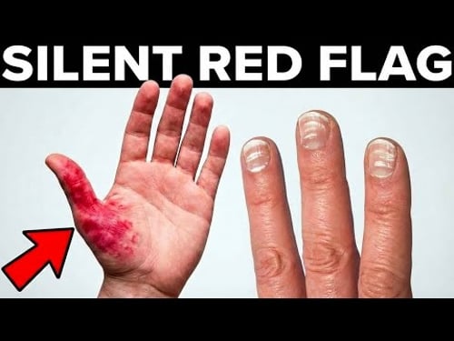 11 Liver Damage Signs That Appear Months Before Liver Cirrhosis