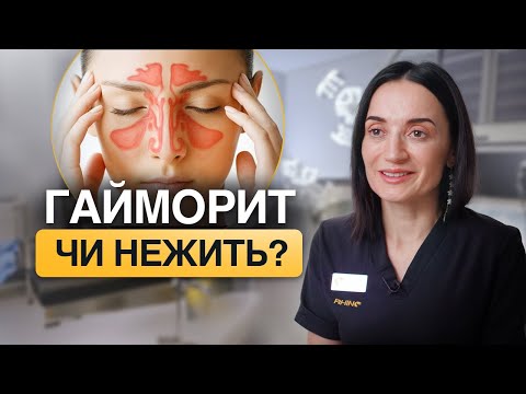Не пийте антибіотики безконтрольно! Причини гаймориту та доказові методи лікування.