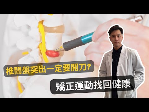 椎間盤突出一定要開刀!? 不用開刀的矯正運動及自我檢查|物治歐巴 Oppa physio