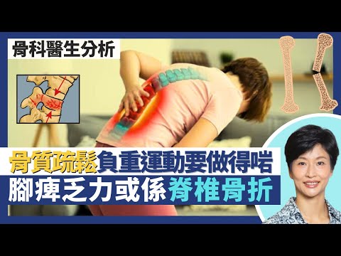 骨質疏鬆與骨折(下)|雙腳麻痺乏力可能係脊椎壓迫性骨折?每日曬太陽15分鐘助吸收鈣質避免骨質疏鬆!骨質疏鬆症多做負重運動強化骨骼但勿做錯種類!|王建芳醫生 骨科醫生文浩然醫生|人類健康研究所