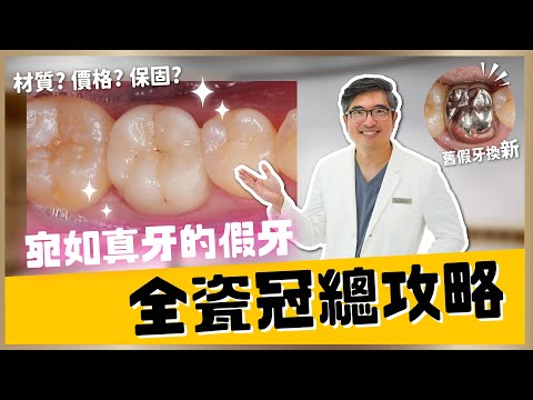 【假牙 #4】一支影片讓您認識全瓷冠假牙總攻略!完整解析全瓷冠的優缺點、價格、材質與適用情況?|【祐民牙醫-隱適美旗艦店】鑽石級楊大為醫師 #牙齒矯正 #根管治療 #假牙 #全瓷冠