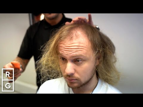 He Didn't Look Like the SAME Person after INCREDIBLE Thinning Hair Transformation