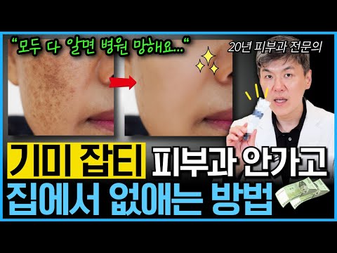 "헛돈 쓰지말고 이것부터 발라보세요" 기미 없애는 모든 방법을 20년차 피부과 전문의가 알려드립니다 (ft.기미 잡티, 주근깨, 흑자, 검버섯 홈케어)