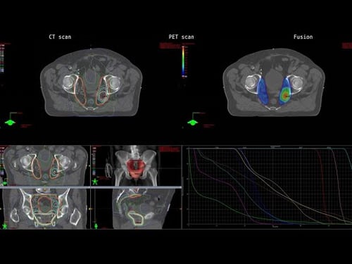 OTT: FACBC: The Story
