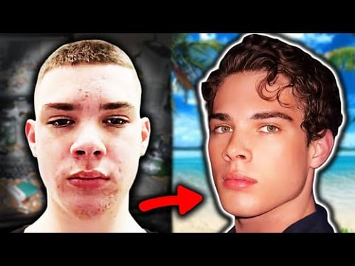 The Curious Case of Clavicular