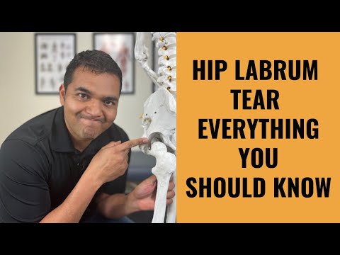 Hip Labrum Tears - Everything You Absolutely Need To Know