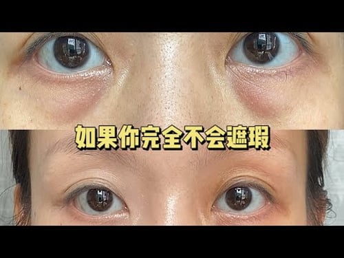 新手入门必看❗️万能遮瑕大法❗️