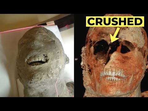 CT Scans Reveal Pompeii's Victims Had Horrifying Deaths