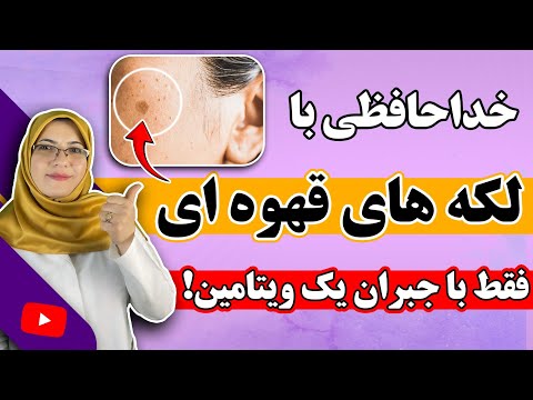 این ویتامین رو جبران کن، لکه های قهوه ای و پیری برای همیشه محو میشن!