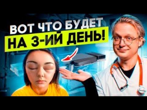 Surgeons are forbidden to talk about this! Rehabilitation from A to Z