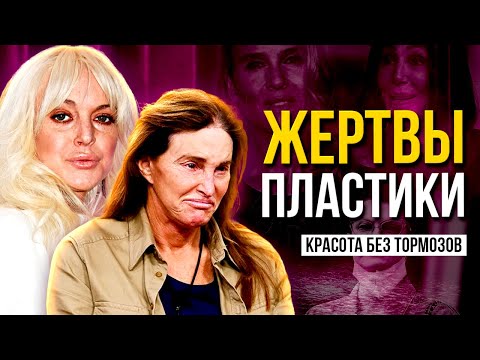 ЖЕРТВЫ ПЛАСТИКИ: В ПОГОНЕ ЗА КРАСОТОЙ ПОТЕРЯЛИ СЕБЯ