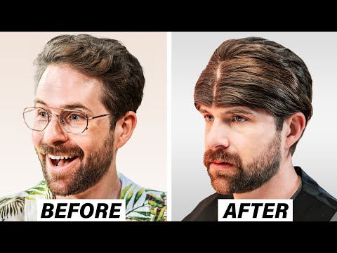 I Regret My Turkish Hair Transplant