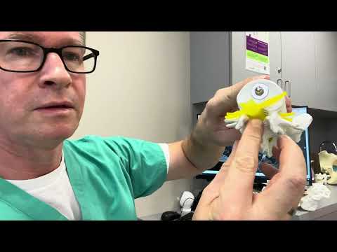 Stenosis: The future of minimally invasive spine surgery, 2026. MIS4LSS.