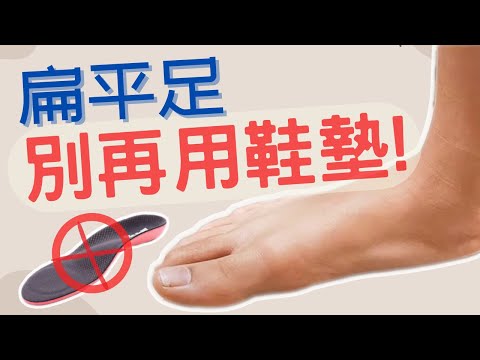 『每天5分鐘』矯正扁平足,擺脫足底筋膜炎!(別用足弓鞋墊了)