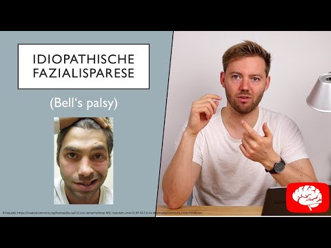 Idiopathische Fazialisparese - Neurologie Grundlagen