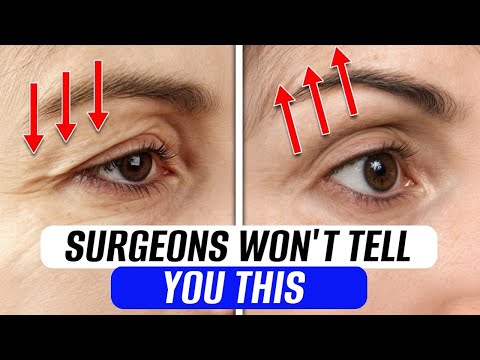 Girls regret not doing THESE EXERCISES earlier! / How to lift drooping eyelids WITHOUT SURGERY?