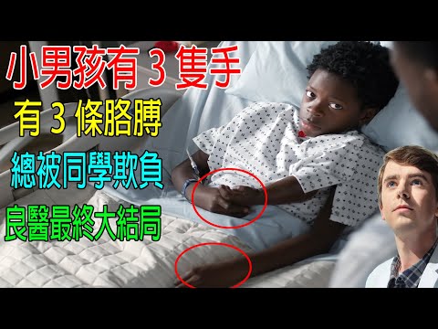 小男孩有3隻手,3條胳膊,總被同學欺負,神醫開大招“死神退位”救治,良醫最終大結局!