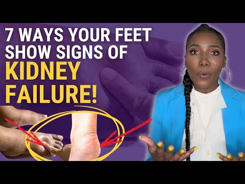 7 TOXIC Signs of Kidney Failure In Your Feet! No. 5 Is SNEAKY!